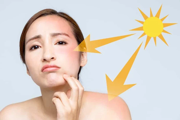 Đi biển nên dùng kem chống nắng SPF bao nhiêu? 3 Ánh nắng tại bãi biển nguy hiểm như thế nào?