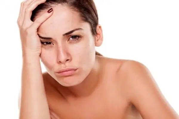 Nguyên nhân gây thâm quầng mắt 6 Mất lớp mỡ dưới da là nguyên nhân gây thâm quầng mắt