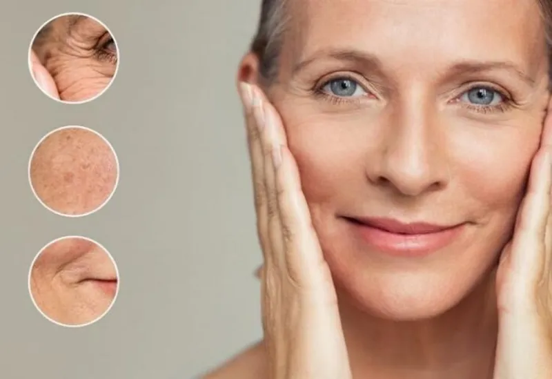 Những vị trí nếp nhăn thường xuất hiện rõ nhất